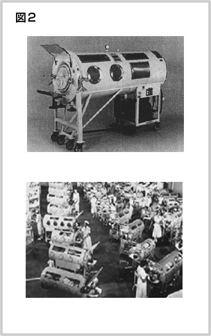 図21950年ごろのICUの写真。鉄の肺が大量に並んでいる。　出典Wikipedia
